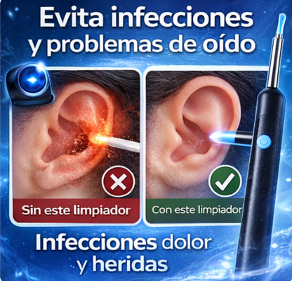 Limpiador de Oídos con Cámara